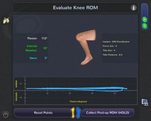 Blue Belt Technologies Knee Robot: evaluate knee ROM (range of motion)