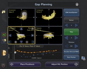 Blue Belt Technologies Knee Robot: Gap planning