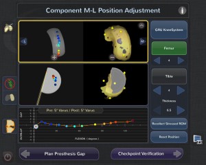 Blue Belt Technologies Knee Robot: position planning